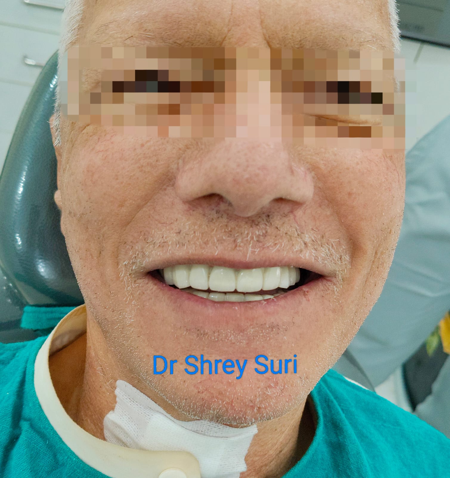 Happy patient after smile makeover