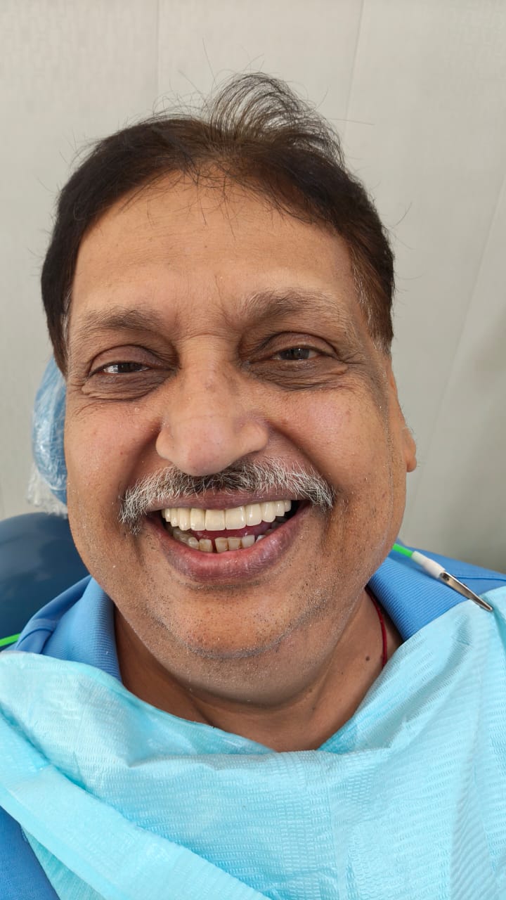 Happy patient after implant-supported dentures